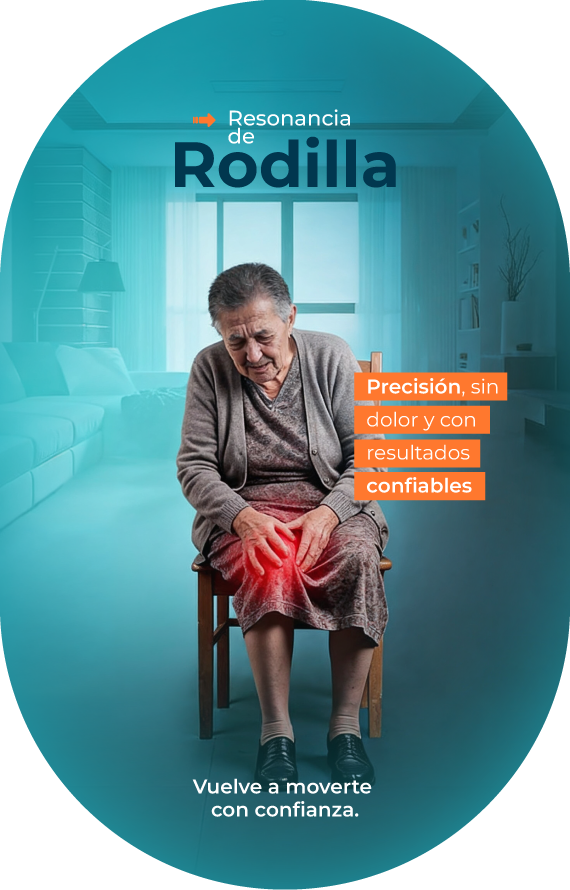 RM-Rodilla