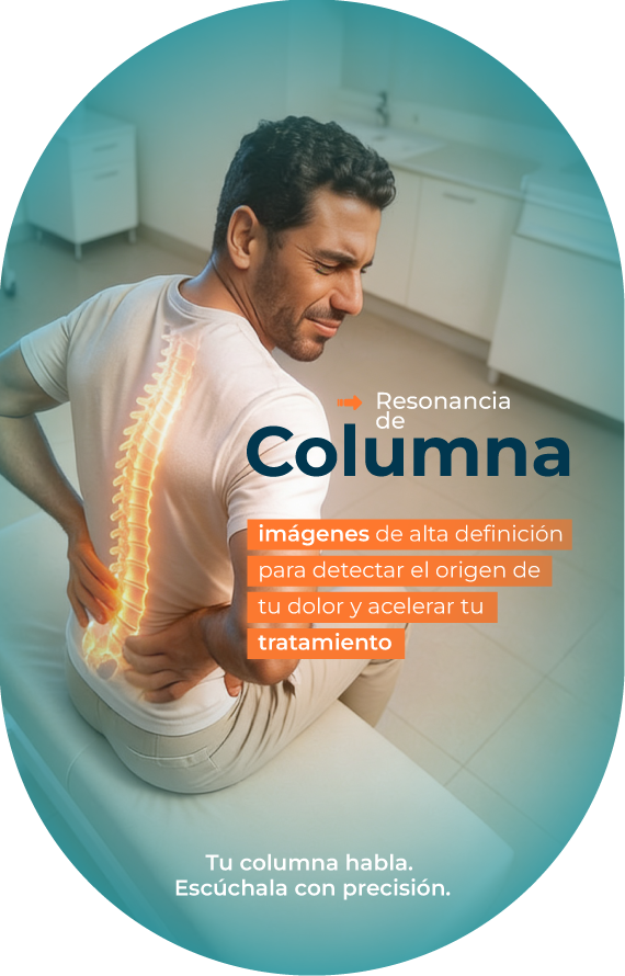 RM-columna